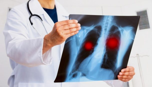 shutterstock_21289950201